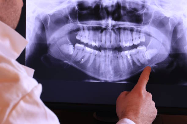 Best Weekend Emergency Dentist in Suwanee, GA